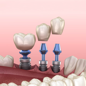 Family Smile Dental Center image