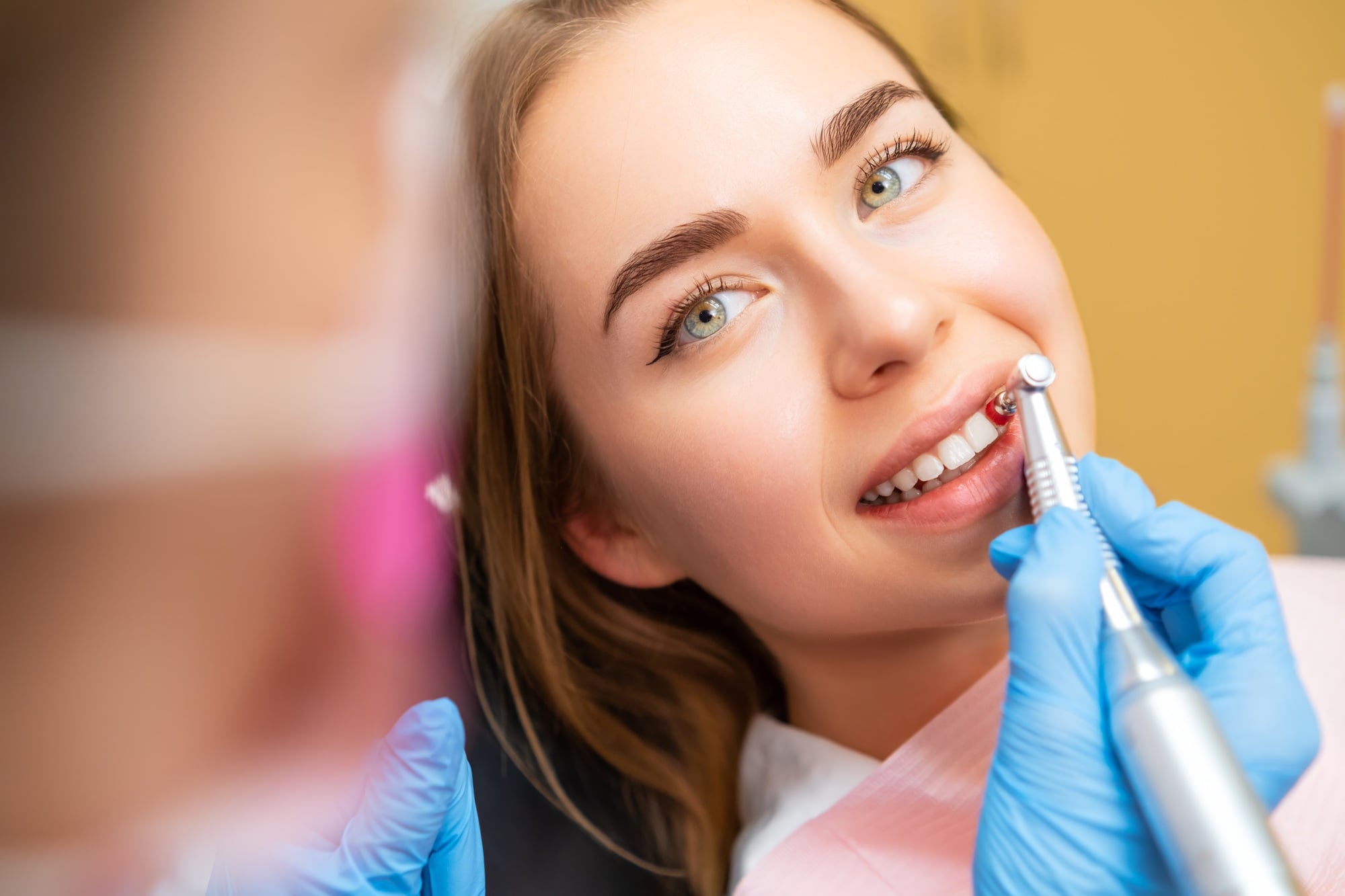 Icon Dental Center Everett image
