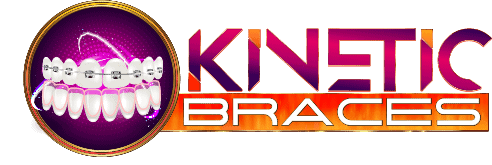 Kinetic Braces image