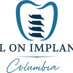 All On Implants Columbia image