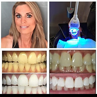 Yevonne’s Elite Teeth Whitening LLC (DaVinci) image