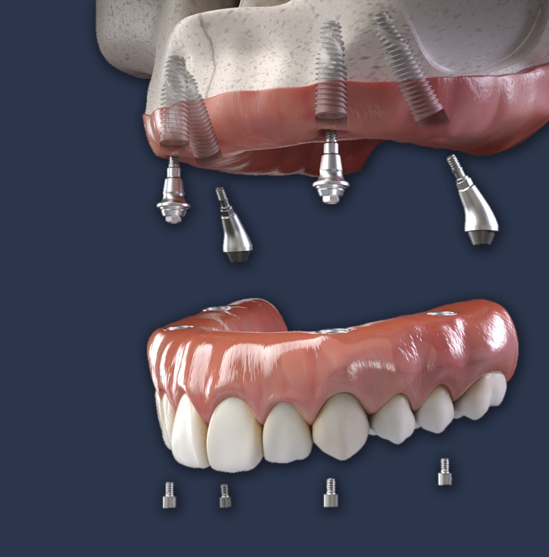 Central Coast Dental Implant Center image
