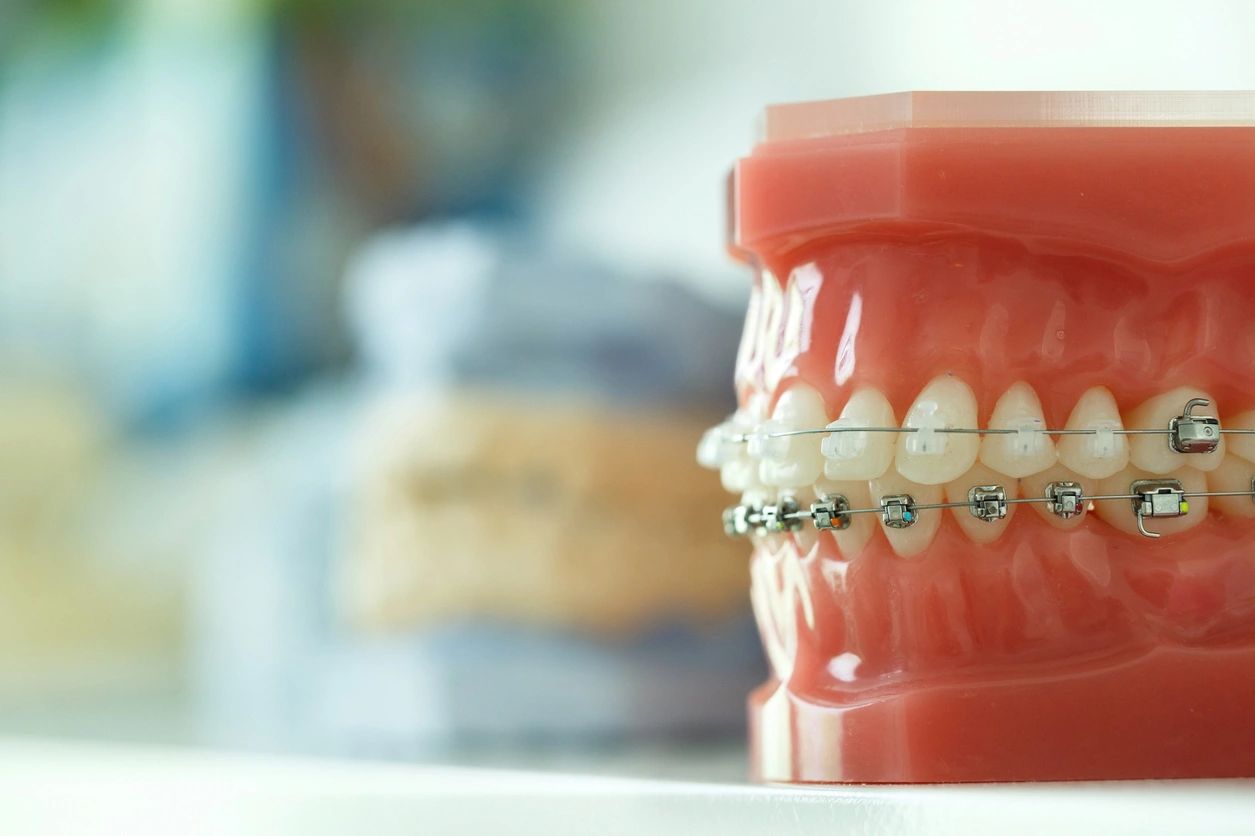 Christopher N Modjeski, DDS, Inc. - Orthodontics image
