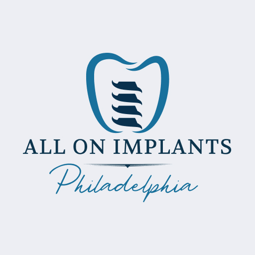All On Implants and Modern Dentistry image