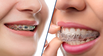 Excel Orthodontics - Braces and Invisalign for Kids and Adults image