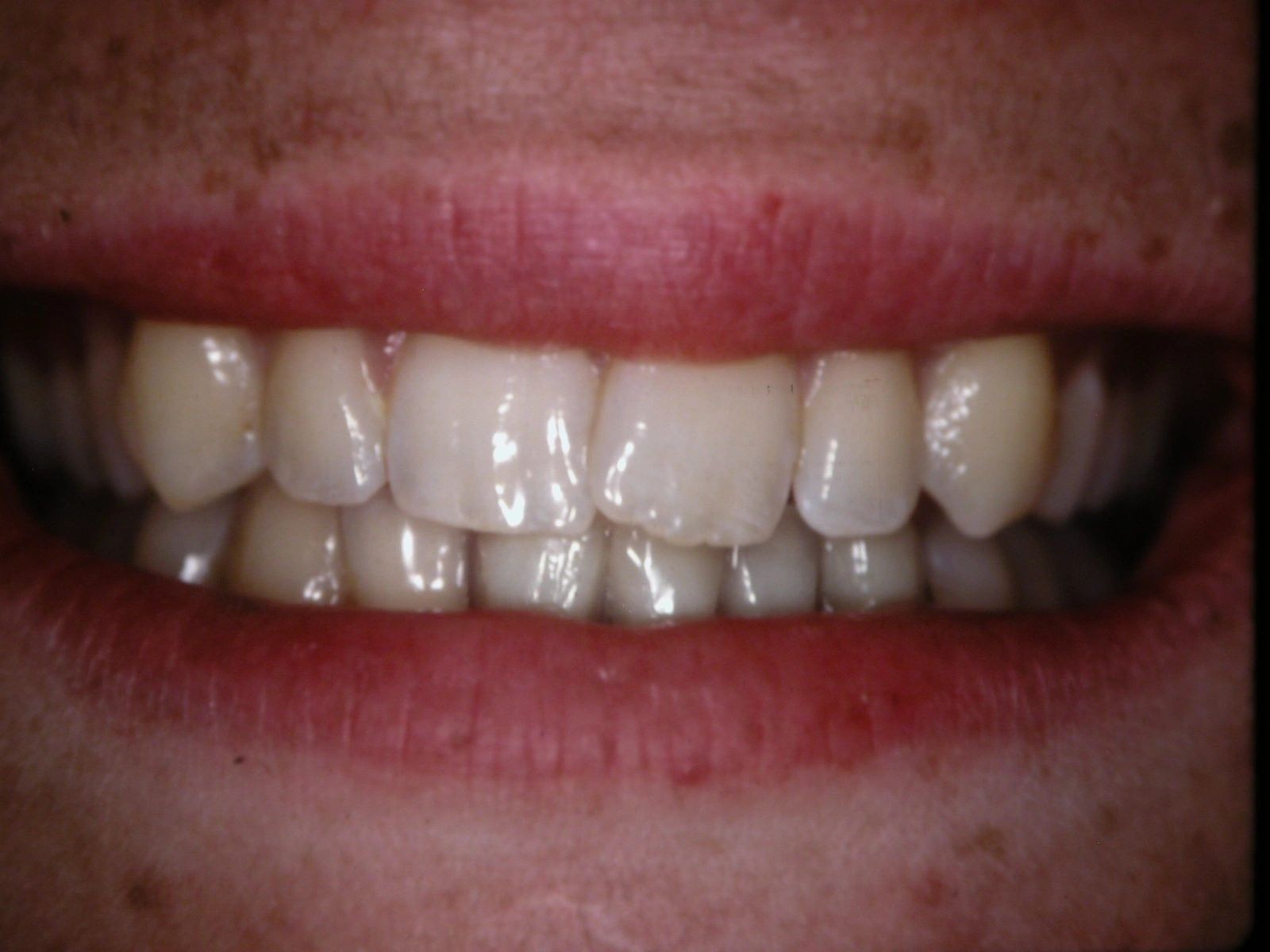 Dentures & Dental image