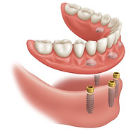 Dayton Dental Group image