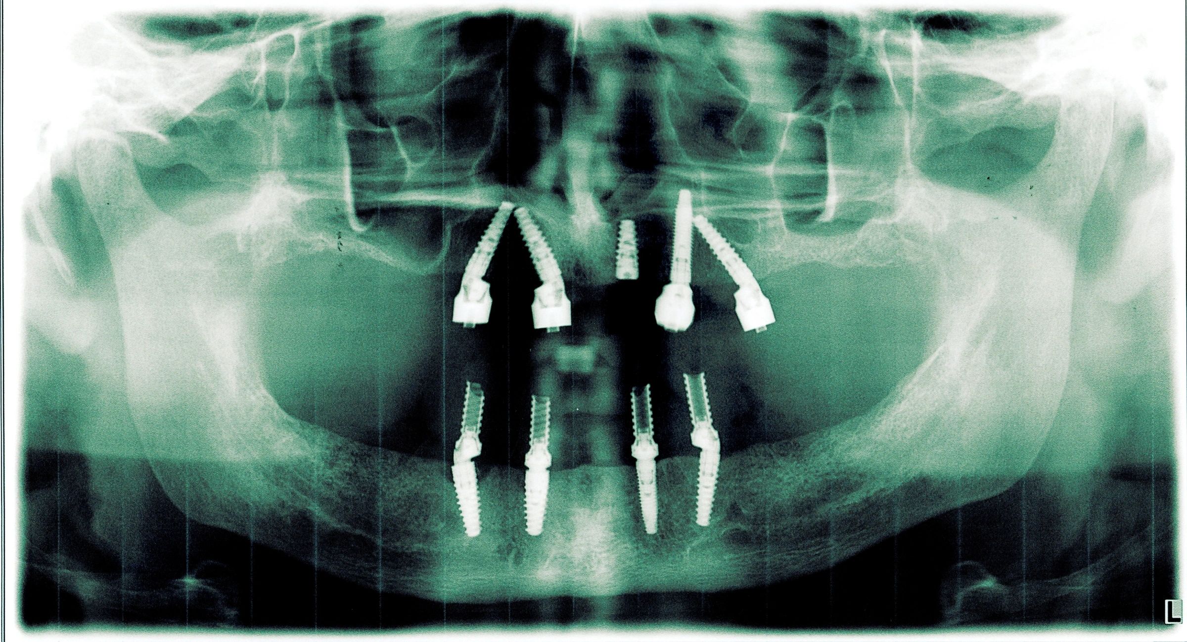 Akron Highland Oral & Maxillofacial Surgery Associates image
