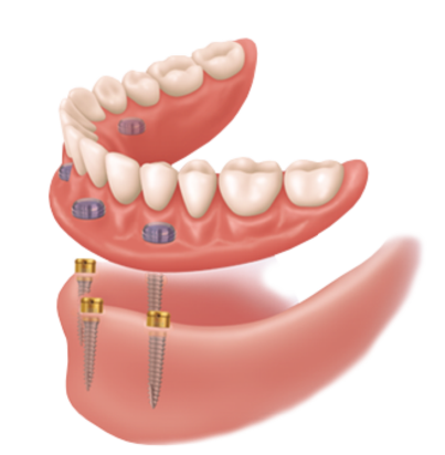 Zealous Dental Hamilton image